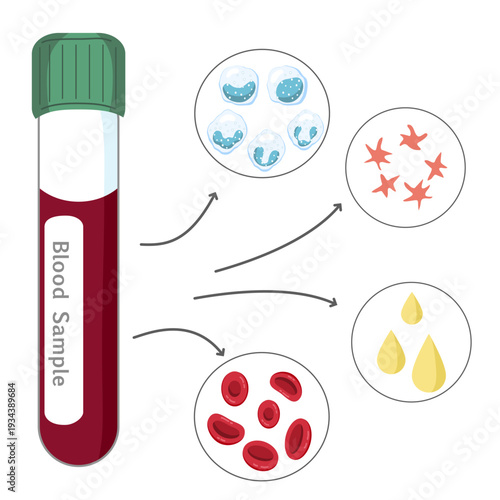 Blood Sample Analysis - Blood Tube with Red and White Blood Cells, Platelets, and Plasma