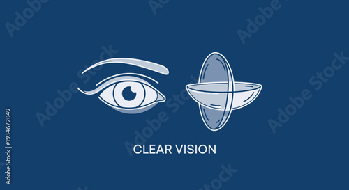 Clear Vision Illustration: An Eye and Contact Lens Graphic Depicting Visual Clarity