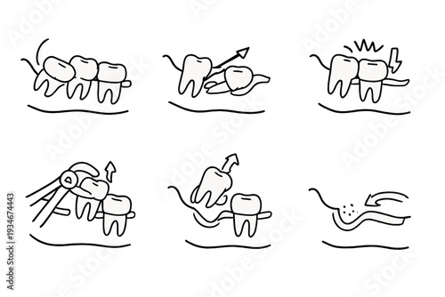 Dental care process with tooth illustrations showing various stages of