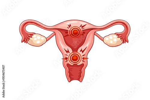 Diagram shows female reproductive system with labeled organs and areas