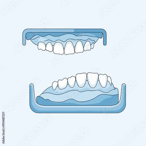 Dental Casts Depicting Upper and Lower Jaws: A Detailed Anatomical Illustration