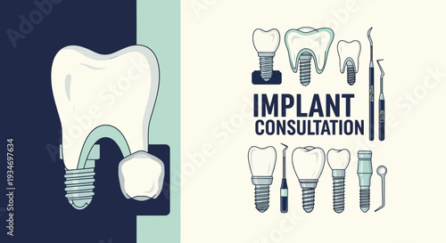 Dental Implants And Consultation: A Comprehensive Visual Guide for Professionals