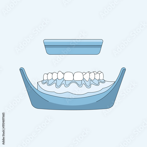 Dental Impression Tray Depicting Teeth with Mouthguard, Medical Illustration of Teeth Impression