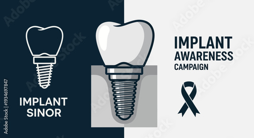Dental Implant Awareness Campaign And Oral Health Education Graphic Design