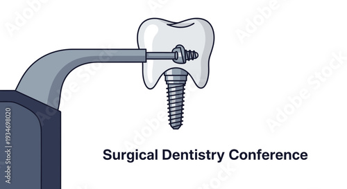 Dental Implant Illustration Demonstrating Surgical Procedure for Dentistry Practices