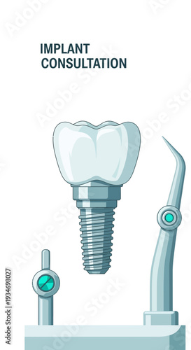 Dental Implant Illustration Demonstrating Tooth Replacement Procedure for Consultations and