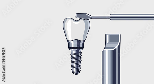 Dental Implant Illustration Demonstrating The Placement Of The Prosthetic Tooth