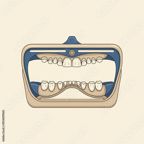 Dental Orthodontic Mouth Retractor Illustration: Accurate Representation and Medical Perspective