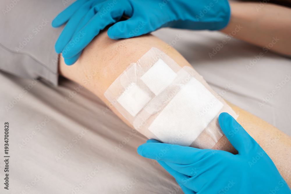 Fototapeta premium Healthcare worker in gloves carefully adjusts adhesive dressing on male patient bruised knee. Concept of professional wound management, nursing care, clinical hygiene in post-trauma recovery process