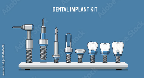 Illustrated Dental Implant Tools And Components For Dentistry Procedures