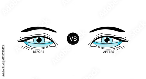 Illustration Comparing Eye Appearance, Before And After, Simple Cosmetic Treatment Graphic