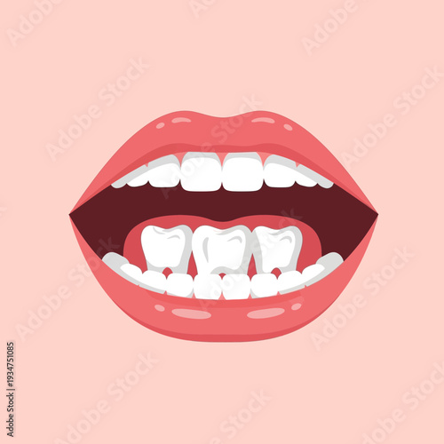 Illustration Of A Healthy Mouth Exhibiting Perfect Teeth With Red Glossy Lips, Mouth Anatomy