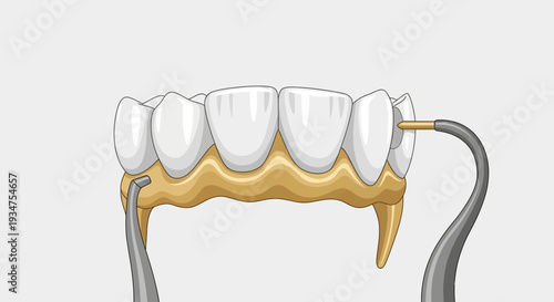 Illustration Of Dentist Applying A Gold Grill, Dental Care, And Artistic Visual