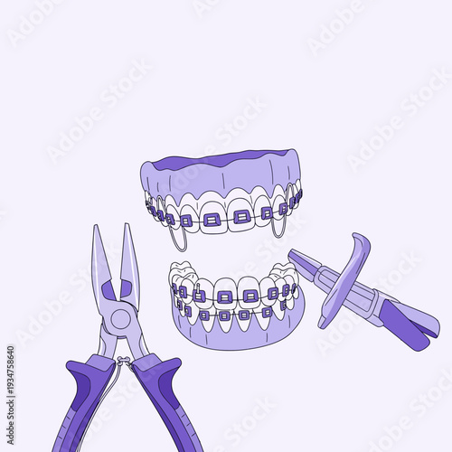 Illustration Of Orthodontic Dental Tools And Teeth Braces For Orthodontic Treatment And Care