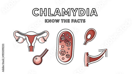 Chlamydia Awareness Infographic with Reproductive System and Bacteria Illustration.