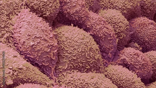 Post menopausal uterus, SEM