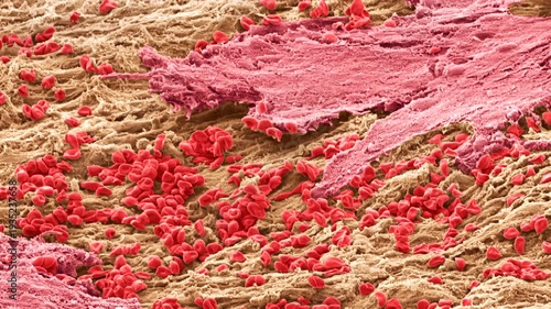 Uterus lining during menstruation, SEM