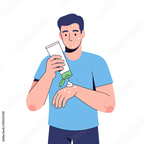 Young man applying cream on skin with acne at home  