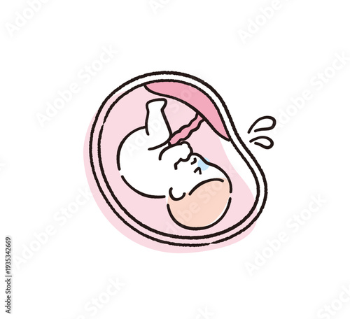苦しそうな赤ちゃん｜出産・医療説明用イラスト