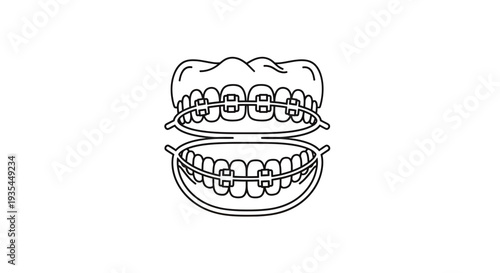 Dental Braces Icon: Upper and Lower Jaw, Orthodontic Treatment
