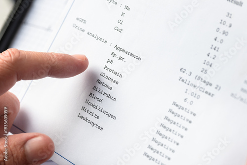 Cuadro en lienzo Doctor reviewing urine analysis laboratory report during medical examination
