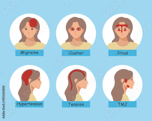 Female Headache Types and Pain Locations Infographic Set