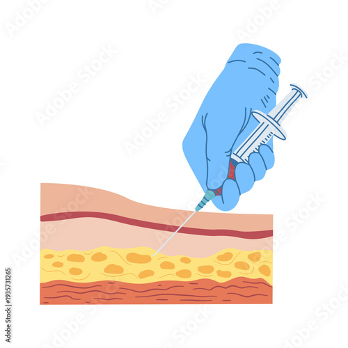 Obraz na płótnie Medical professional administers injection deep into the subcutaneous fat layer