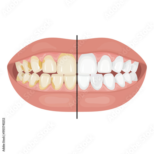 Oral hygiene concept showing clean versus yellow teeth