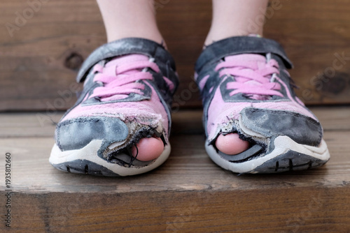 Old Worn Out Shoes with Holes and Toes Homeless Child Representing Poverty
