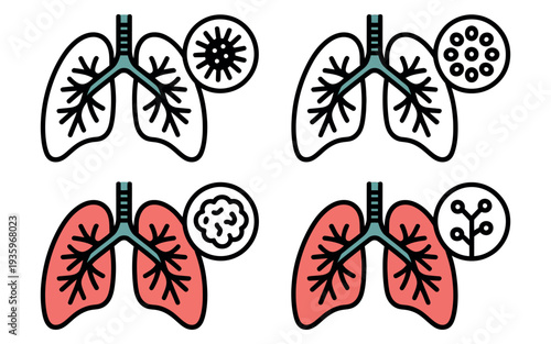 An illustration showing healthy and unhealthy lungs with various disease conditions.