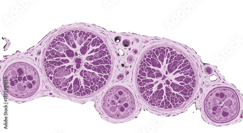 Microscopic view of purple stained cells with varying sizes and structures.