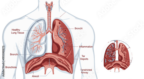 Detailed anatomical diagram of human lungs and respiratory system.