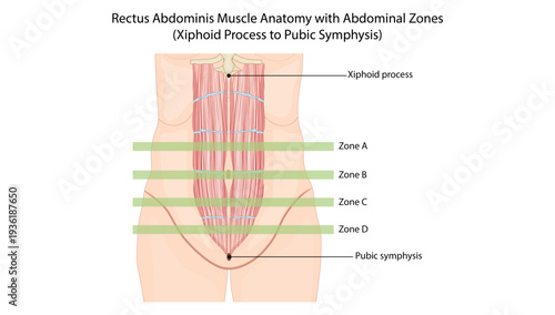 Rectus Abdominis Muscle Anatomy with Abdominal Zones,Medical illustration of the rectus abdominis showing abdominal zones (A–D) from the xiphoid process to the pubic symphysis with tendinous intersect