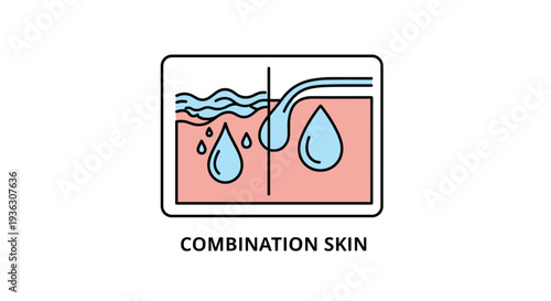 Educational skin care diagram illustrates the characteristics of combination skin with areas of excess oil and dry patches for dermatology.