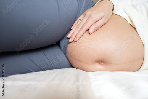 Close-up of Pregnant Belly with Stretch Marks and Linea Nigra