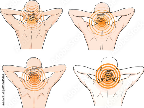 Human back and neck pain vector illustration set showing cervical spine tension with orange circular ache radiating zones