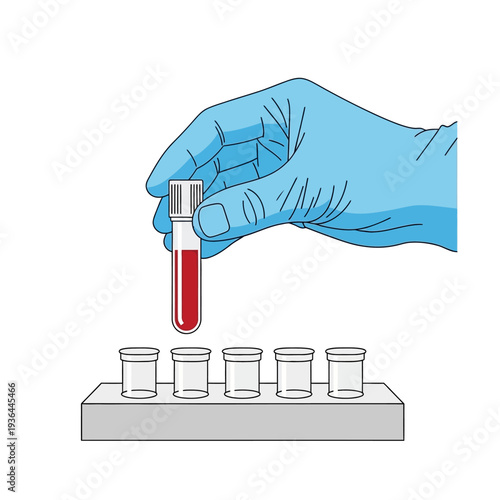 Hand in blue glove holding blood sample tube above rack of empty vials