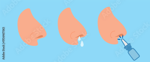 three noses set, nasal spray, nasal drops, medicine on a blue background, 