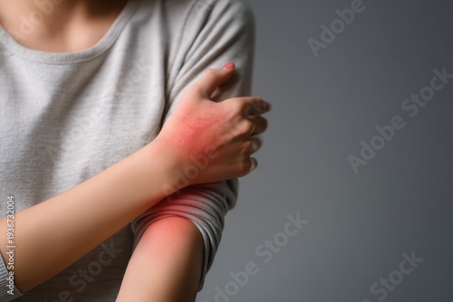 Woman scratching arm with red rash