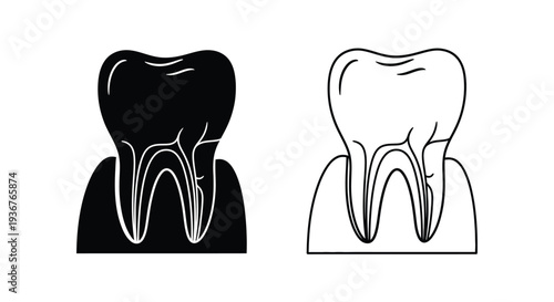 Dental root canal treatment illustration Vector