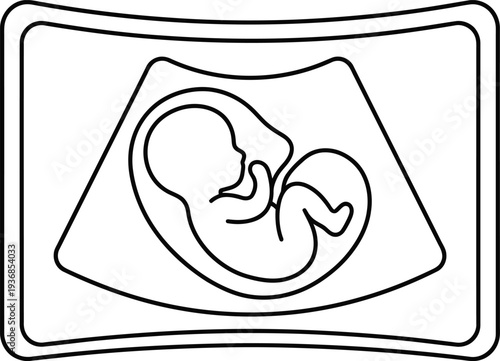 Medical illustration of a fetus in womb