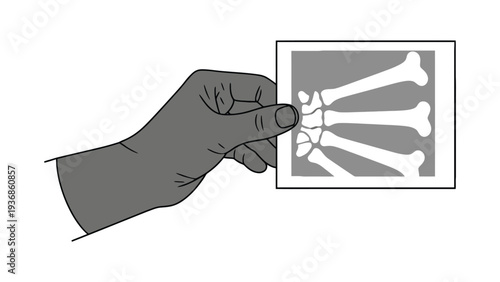 Hand Holding X Ray Film Illustration Representing Medical Diagnosis Radiology and Bone Fracture Analysis