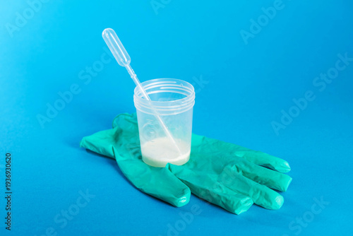 A container with prostate fluid and ejaculate stands on a medical glove against a blue background. Conceptual study of protozoan infection and decreased hormones and libido. 