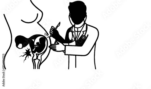 Medical illustration of a doctor performing surgery on a pregnant uterus