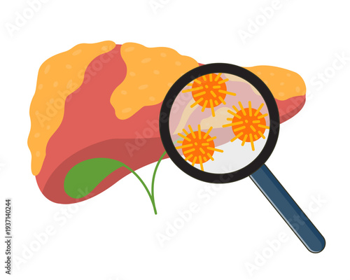 illustration of a fatty liver organ liver disease and health problem
