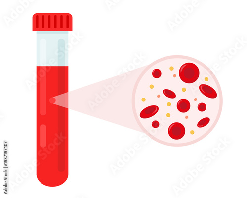 short of red blood cells anemia blood cell laboratory and education vector illustration