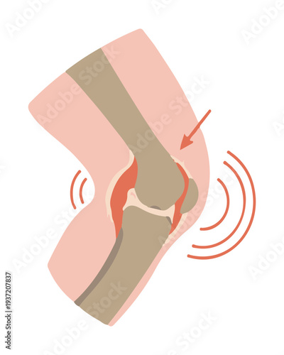 Knee Joint Pain Concept