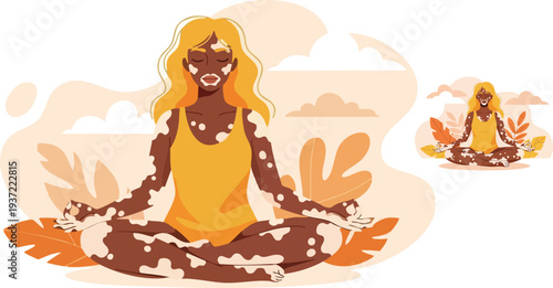 Vector illustration of a woman with vitiligo in a yoga pose
