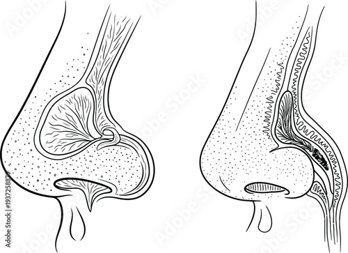 Human nasal cavity anatomy illustration, congested nose, healthy nose, sinusitis, airflow, mucous membranes, nasal septum, medical diagram, biology chart, respiratory system