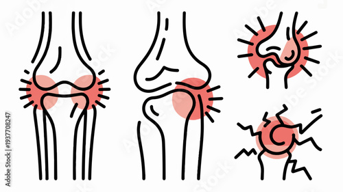 Detailed knee joint pain illustrations with inflamed areas highlighted in red on white background